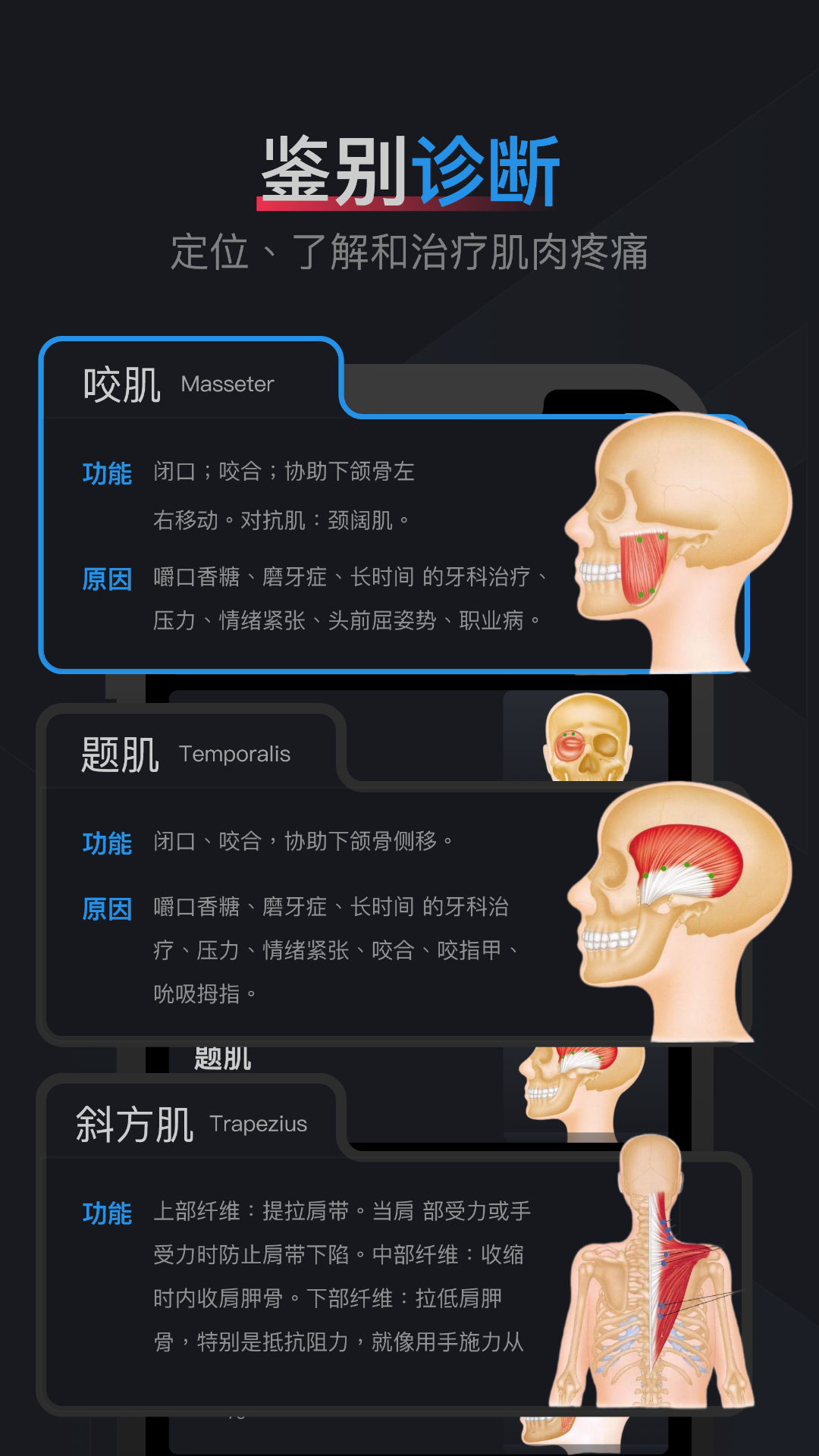 肌肉激痛点图谱app截图