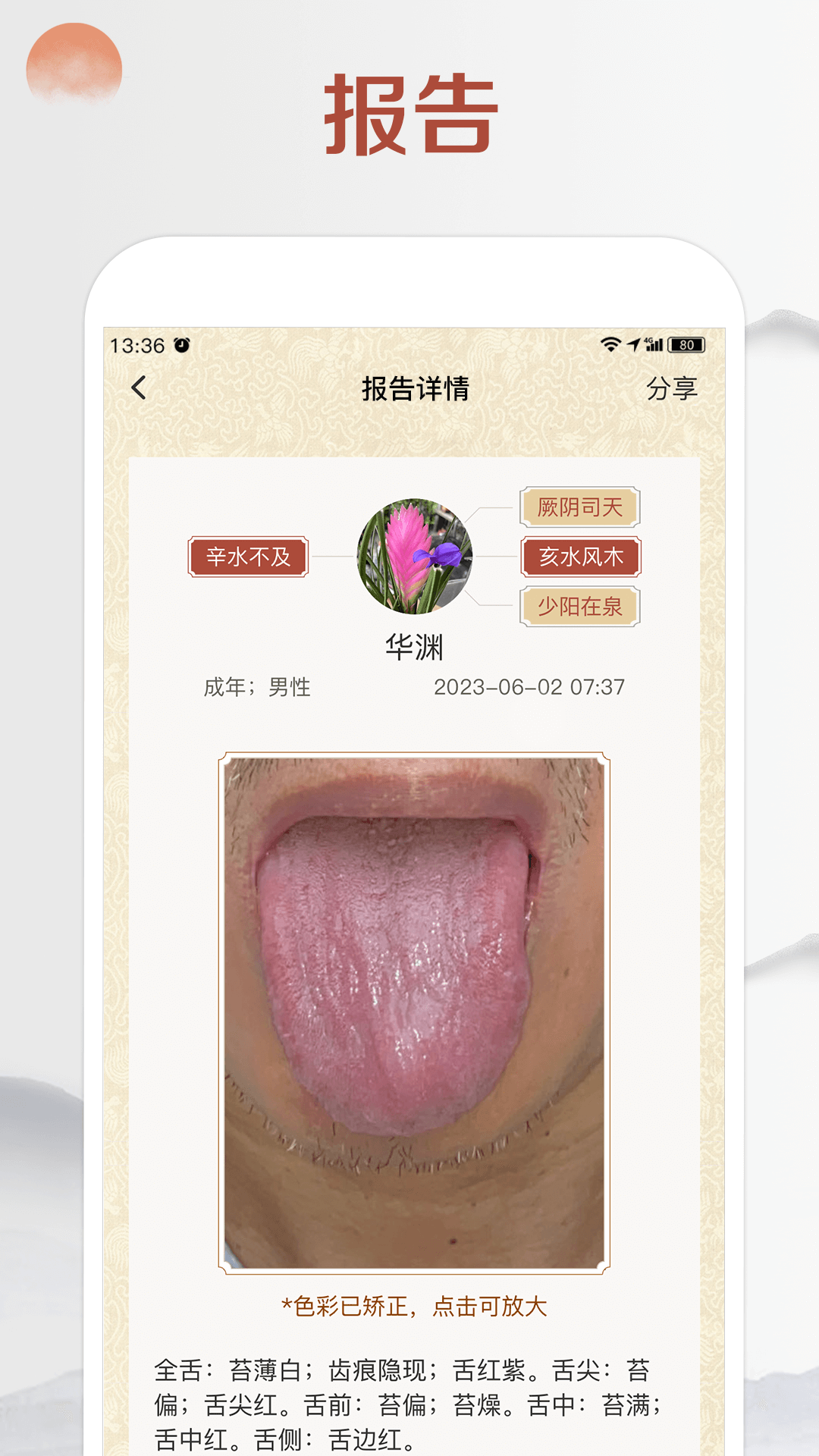 看舌头下载介绍图