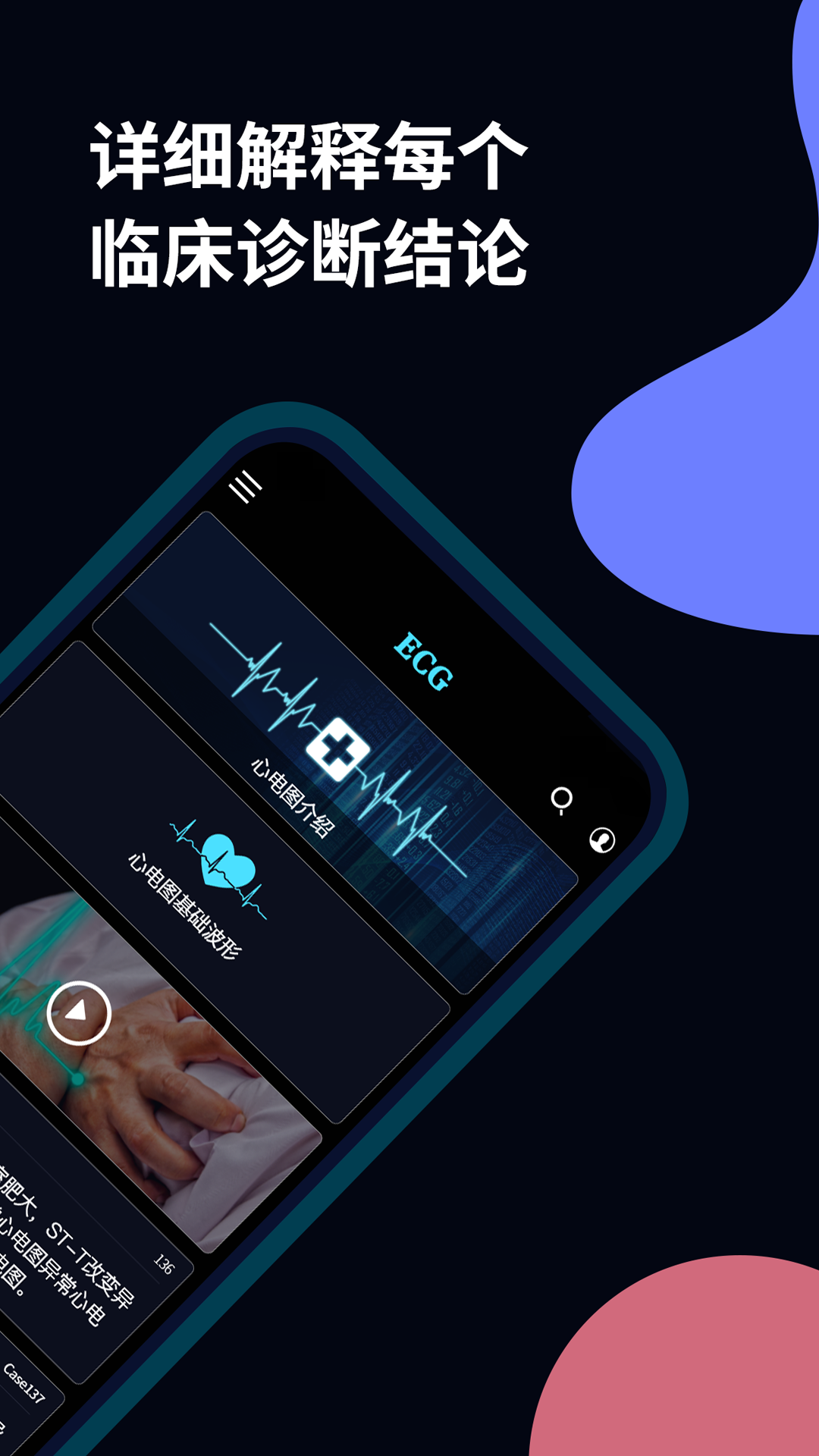心电图ECGapp截图